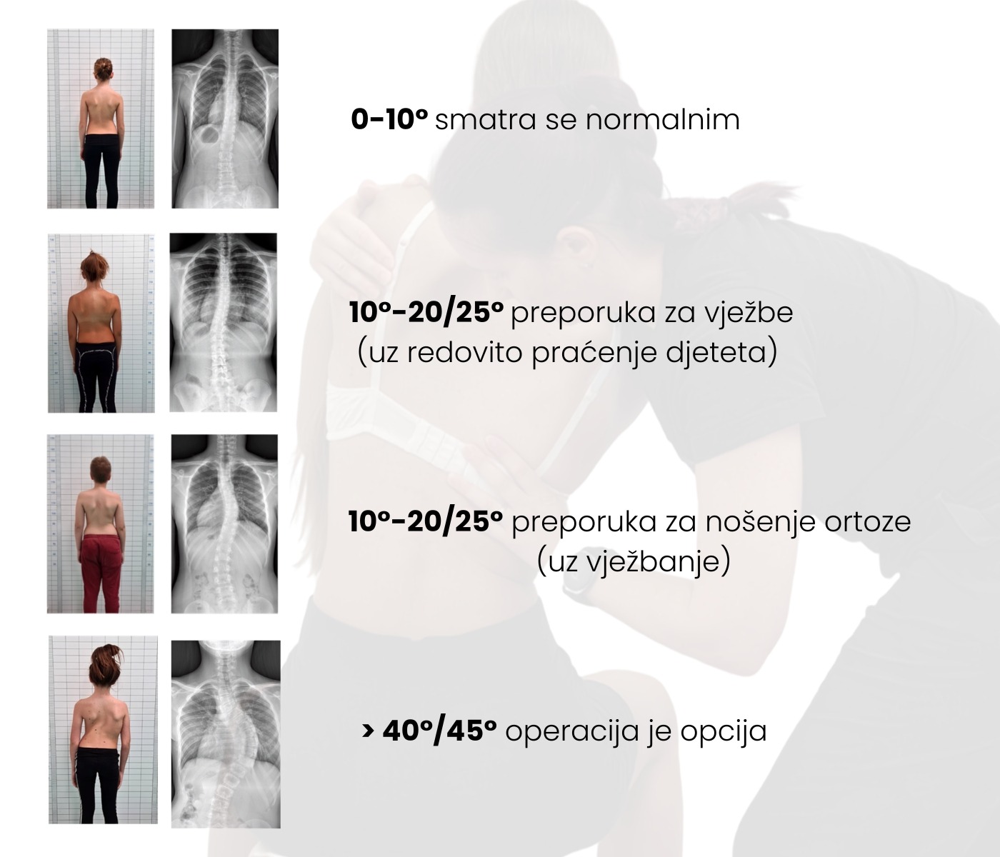 procjena-posture-topografska-kamera-scolio-point.jpeg